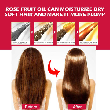 EELHOE Rosehip Facial Oil