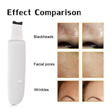 Ultimate Face Cleaner