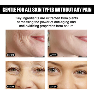 EELHOE Face Facial Skin