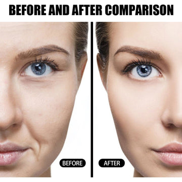 EELHOE Face Facial Skin