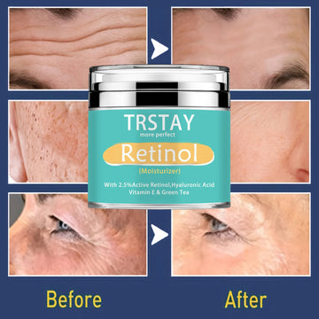 TRSTAY Retinol Moisturizing Cream