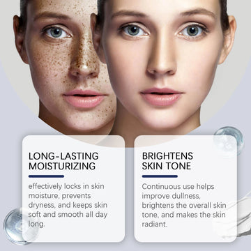 Hoygi Dark Spots Lightening Face Cream