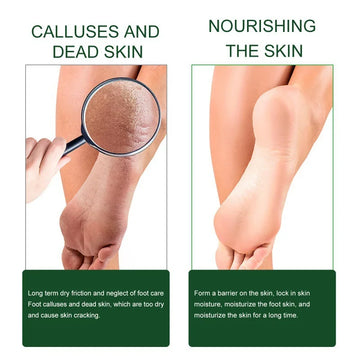 Tea Tree Foot Cream
