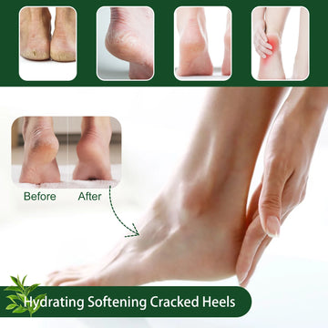 Tea Tree Foot Cream