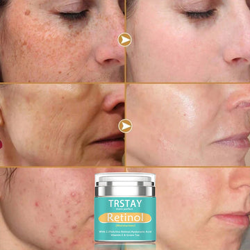 TRSTAY Retinol Moisturizing Cream