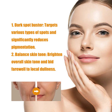 Ouhoe 30ml Dark Spot Removal Serum