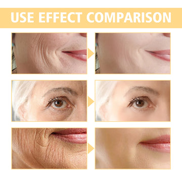 Retinol Anti-wrinkle Cream