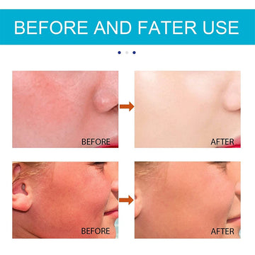 Sunburn Whitening Matte Summer Skin Cream
