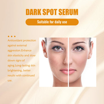 Ouhoe 30ml Dark Spot Removal Serum