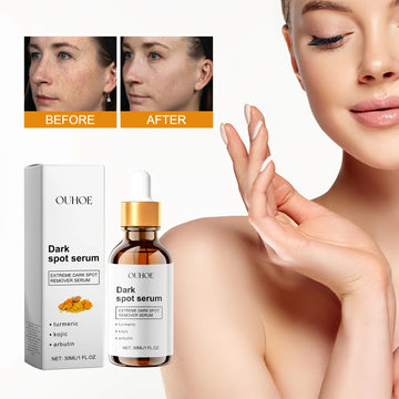 Ouhoe 30ml Dark Spot Removal Serum