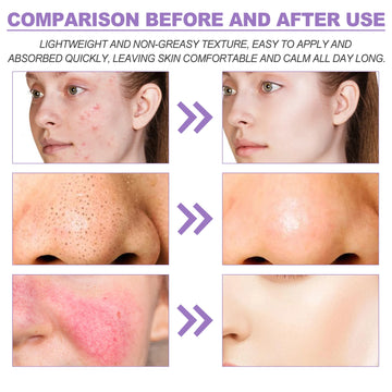 EELHOE Perilla Moisturize Gel