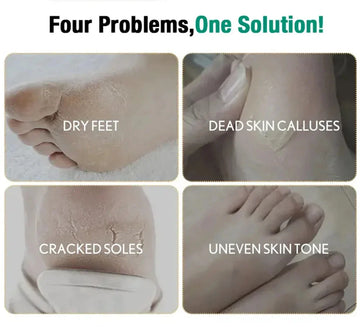 Herbal Anti Crack Foot Cream Spray