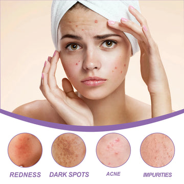 EELHOE Perilla Moisturize Gel