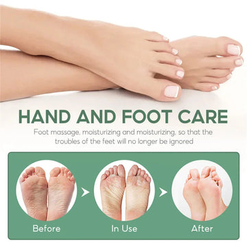 Herbal Anti Crack Foot Cream Spray