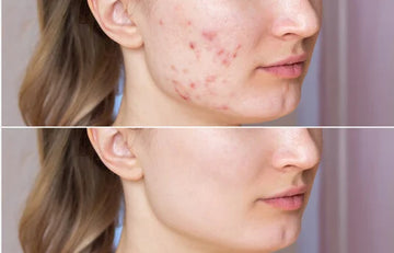 Centella Asiatica Facial