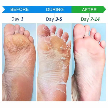 Herbal Anti Crack Foot Cream Spray