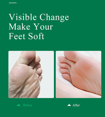MABREM Anti-cracking Foot Cream