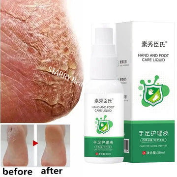 Herbal Anti Crack Foot Cream Spray