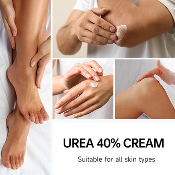 Foot Cream Urea Cream 40% plus Salicylic Acid 2%
