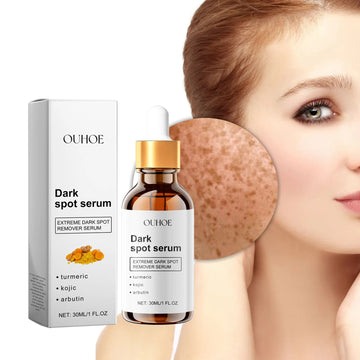 Ouhoe 30ml Dark Spot Removal Serum