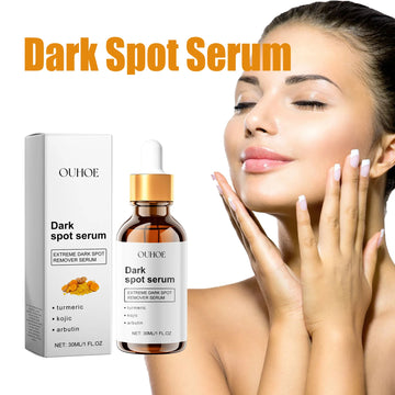 Ouhoe 30ml Dark Spot Removal Serum