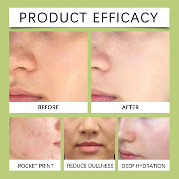Centella Asiatica Facial