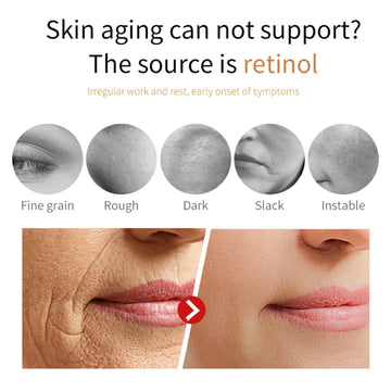 Retinol Face Cream