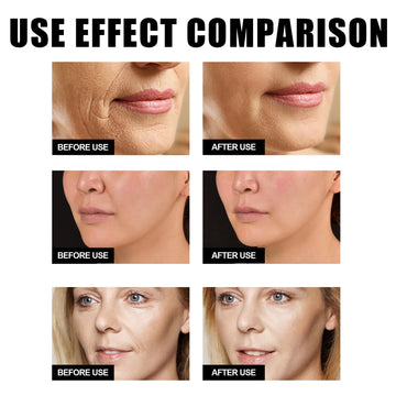 OUHOE Facial Hyaluronic Acid Serum