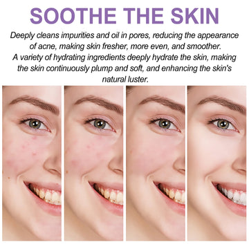 EELHOE Perilla Moisturize Gel