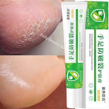 Herbal Anti Crack Foot Cream Spray